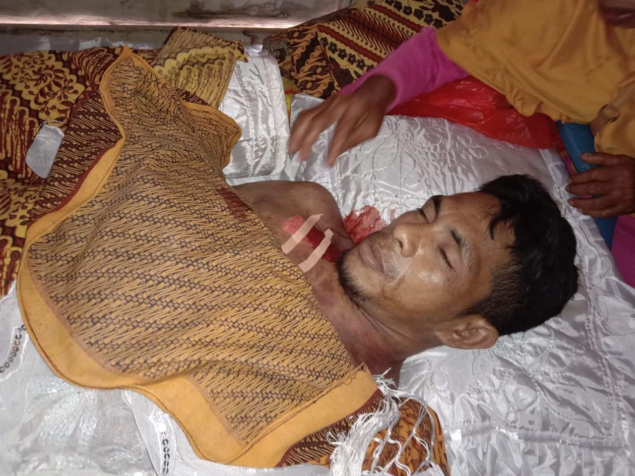 Adi korban meninggal dunia usai ditusuk dengan golok di lokasi tambang emas Desa Kusubibi (Dok: segmen.co.id)