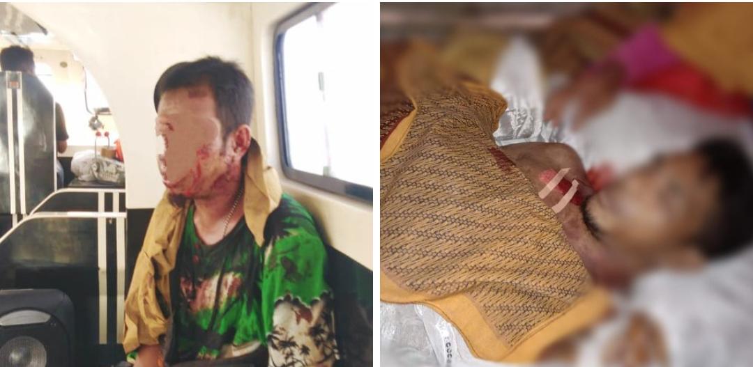 Romi (duduk) pelaku dan Mahdi (korban) terbaring. (Dok: segmen.co.id)